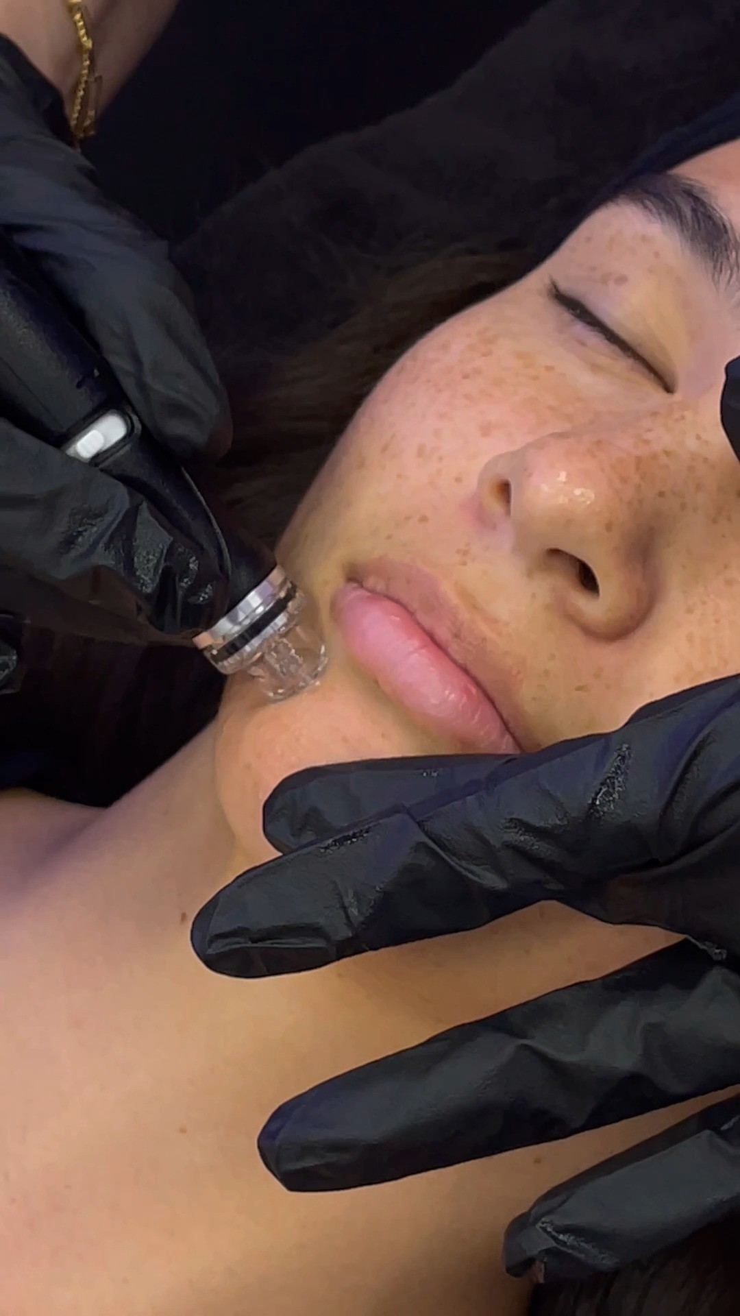 Hydrafacial + été = le combo parfait pour une peau hydratée et lumineuse ! 💧✨
L'exposition au soleil, la chaleur et le sel peuvent fragiliser votre peau…
Le soin Hydrafacial est LA solution pour :
💦 Hydrater intensément l’épiderme
🧴 Nettoyer et exfolier en douceur
🌸 Préparer la peau à un bronzage uniforme et durable
🌞 Apaiser les effets du soleil tout en ravivant l’éclat
En été plus que jamais, une peau éclatante passe par une hydratation en profondeur !
📍 Institut C – Lyon
📞 06 86 16 85 71
#institutclyon #hydrafacial #hydratationpeau #soinvisage #ete2025 #bronzageeclatant #teintlumineux #skincareroutine #lyonbeaute #glowfromwithin