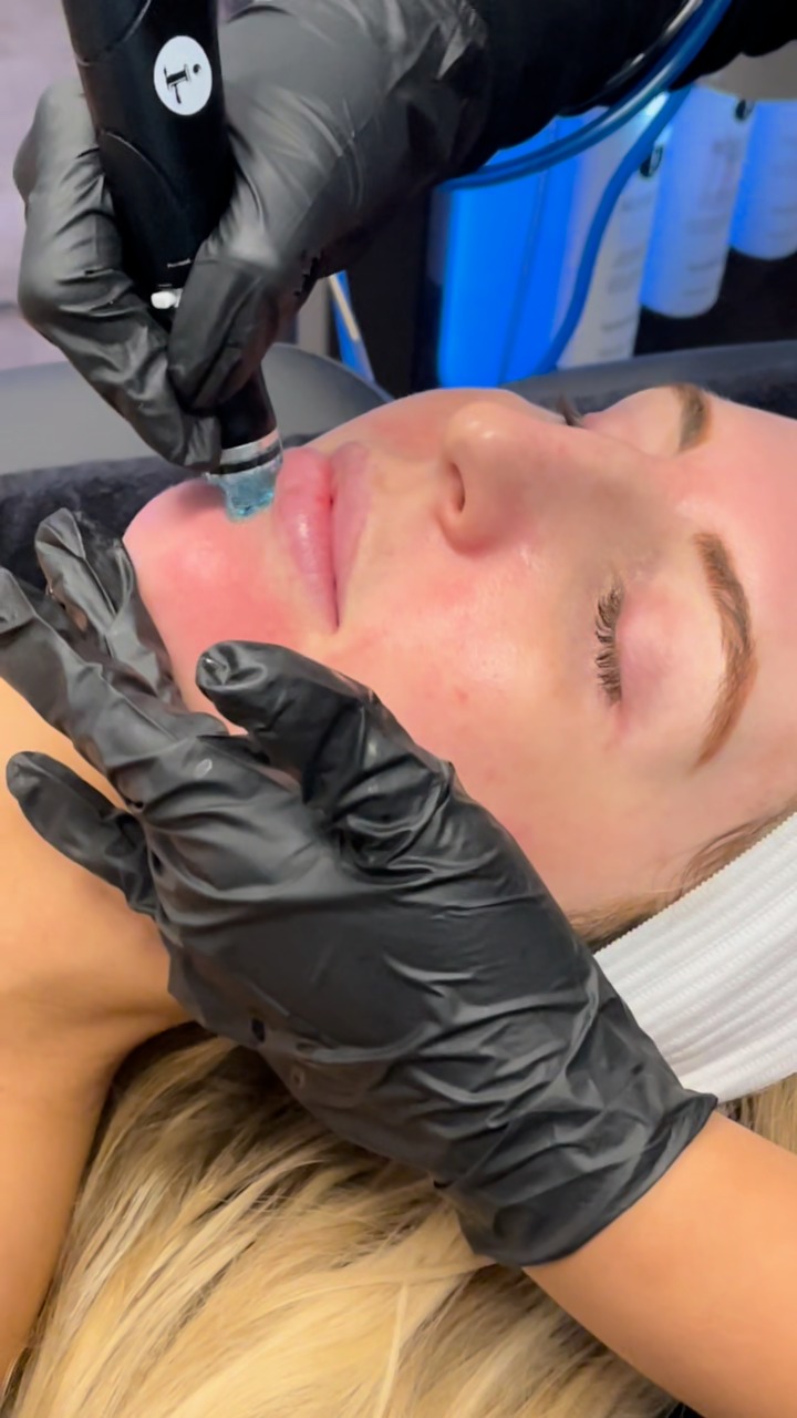 🎧 ASMR Beauté : Exfoliation en douceur avec Hydrafacial 💧
Fermez les yeux, augmentez le son…
Laissez-vous emporter par les sons apaisants de l’exfoliation Hydrafacial
🌿 Nettoyage profond
🌬️ Aspiration douce des impuretés
💦 Hydratation intense
Un moment sensoriel unique pour une peau lisse, lumineuse et parfaitement purifiée
À découvrir dans votre institut préféré.
📍Institut C – Lyon
📞 06 86 16 85 71
#institutclyon #hydrafaciallyon #asmrskincare #exfoliationhydrafacial #soindouceur #glowskin #peauparfaite #lyonbeaute